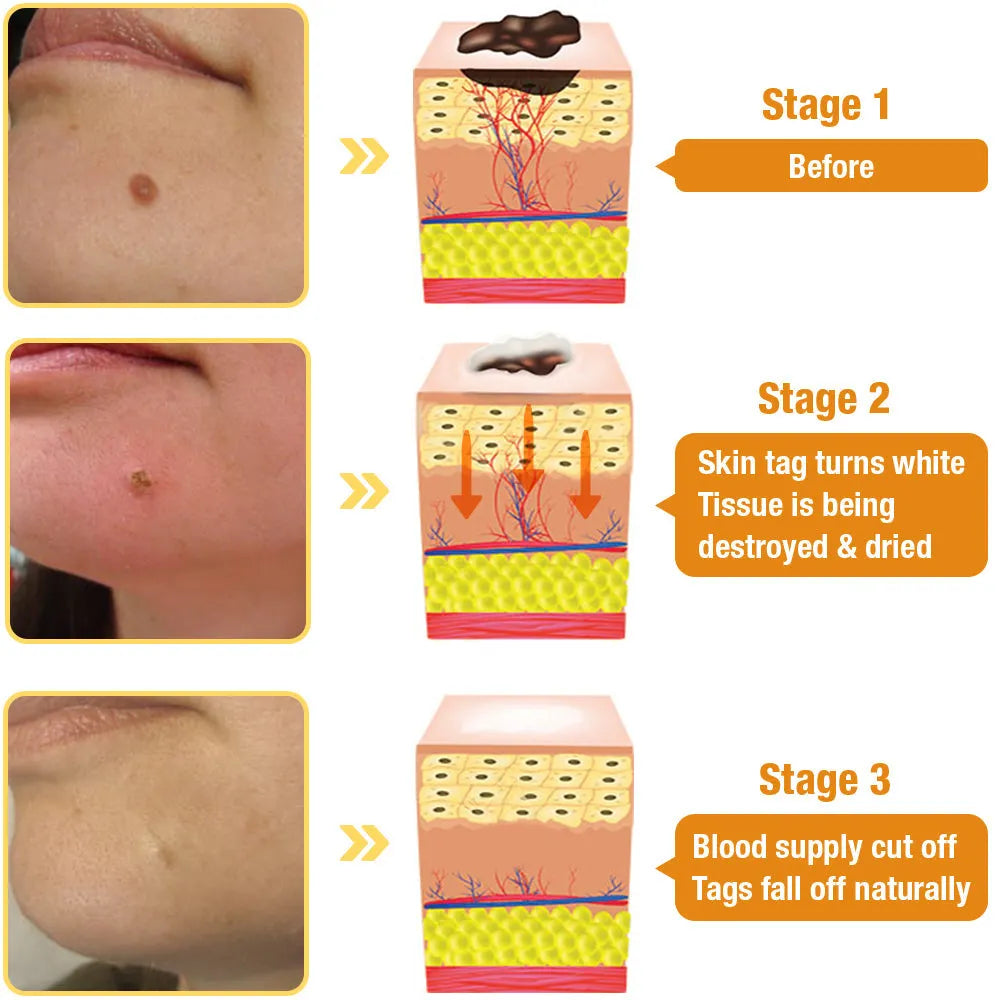 🔥Hot Sale 49% OFF🔥 🐝 TagRecede Bees Repair Spray