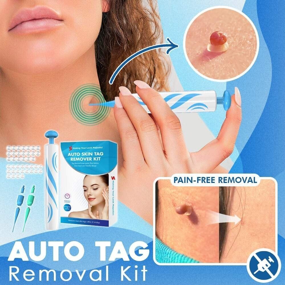 đHot Sale 49% OFFđĽAuto Tag Fast Removal Kit