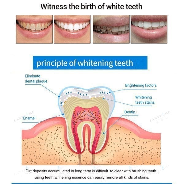 LAST DAY 49%OFF - Teeth Whitening Pens