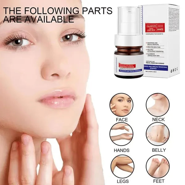 🔥Hot Sale 49% OFF🔥Vitamin C Whitening Freckles Face Cream Remove Melasma Dark Spots Lighten Melanin