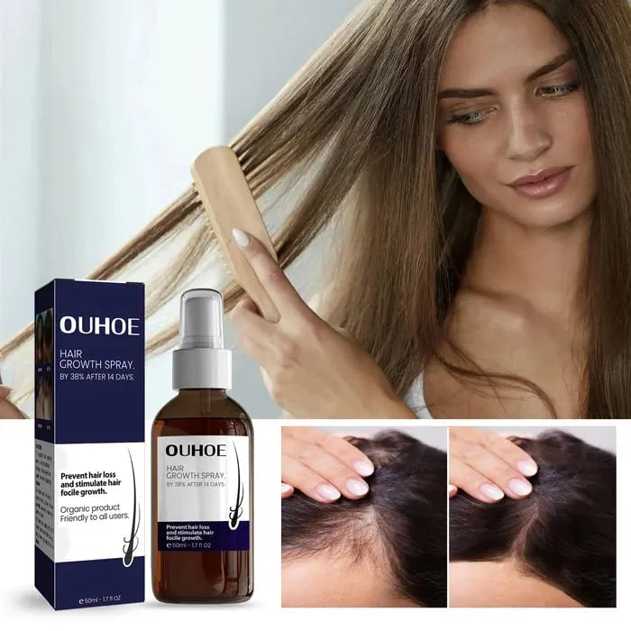 🔥Hot sale 49%OFF🔥Natural Hair Regrowth Spray