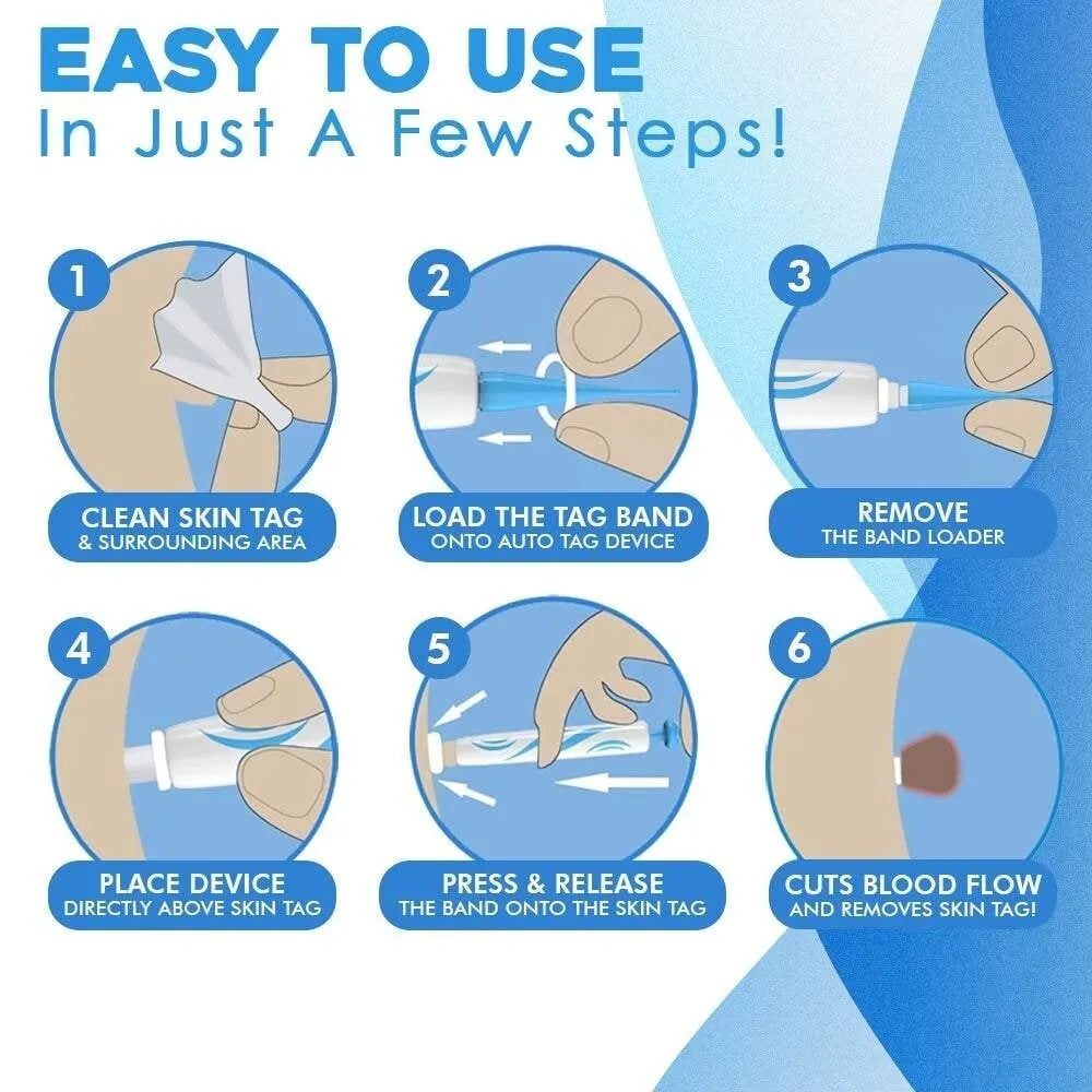 💖Hot Sale 49% OFF💥Auto Tag Fast Removal Kit
