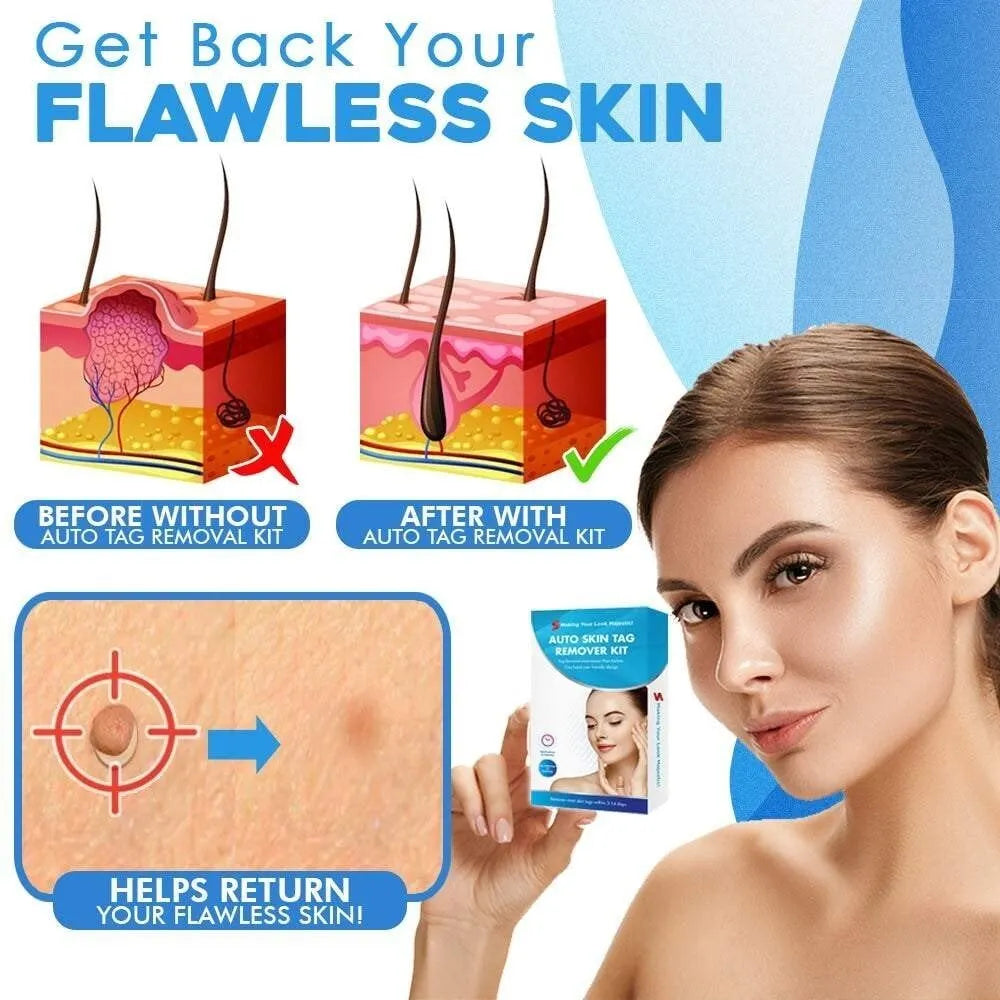💖Hot Sale 49% OFF💥Auto Tag Fast Removal Kit