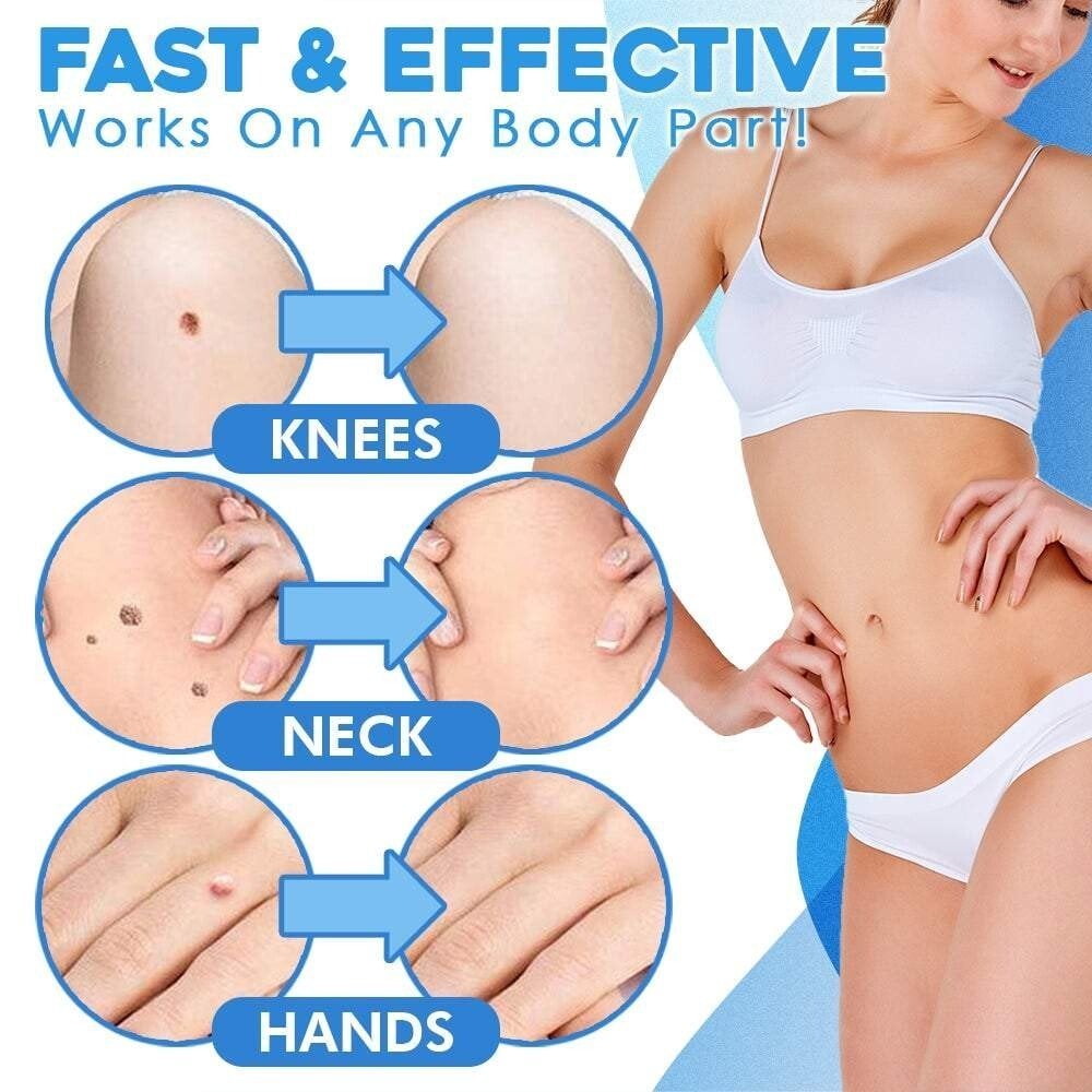 💖Hot Sale 49% OFF💥Auto Tag Fast Removal Kit